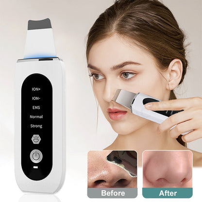 Skincare device with a woman using it on her face, showing before and after effects.